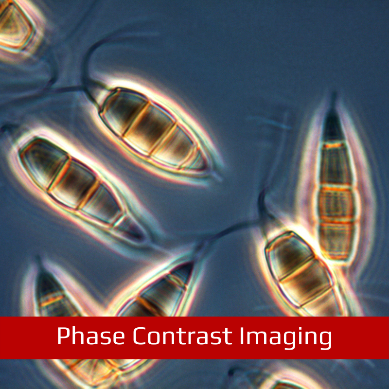 Phase Contrast Imaging