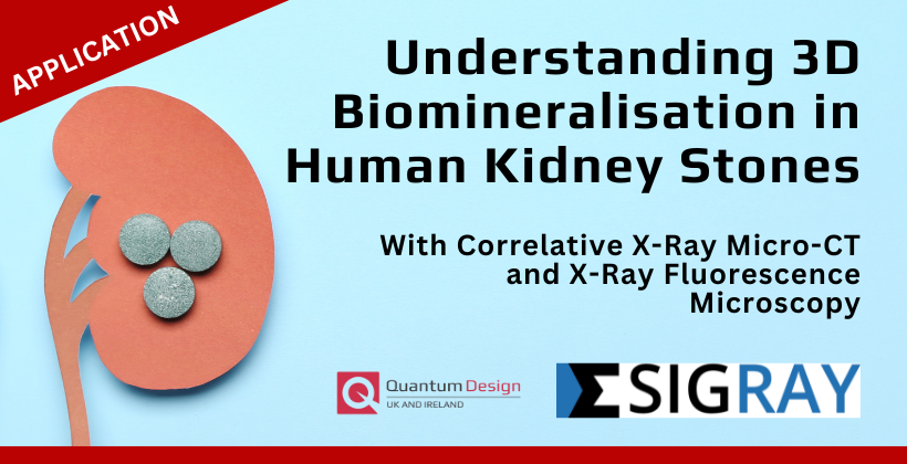 Understanding 3D Biomineralisation in Human Kidney Stones